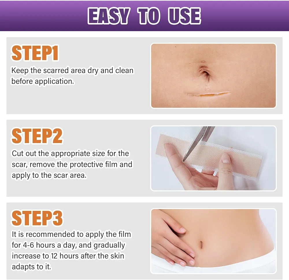 Silicon Scar Tape