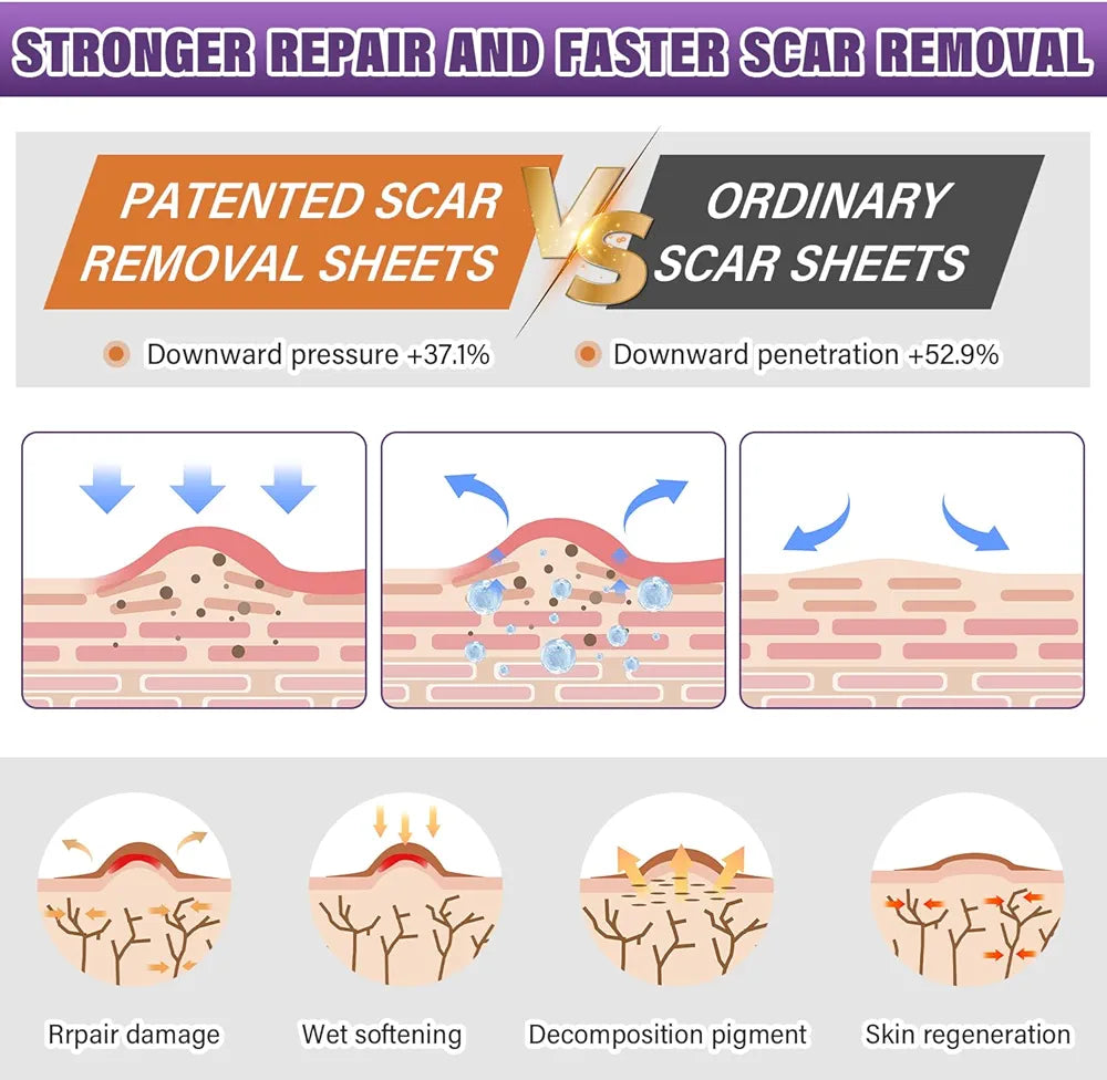 Silicon Scar Tape